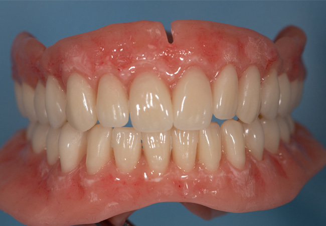 Clark-Dentures6